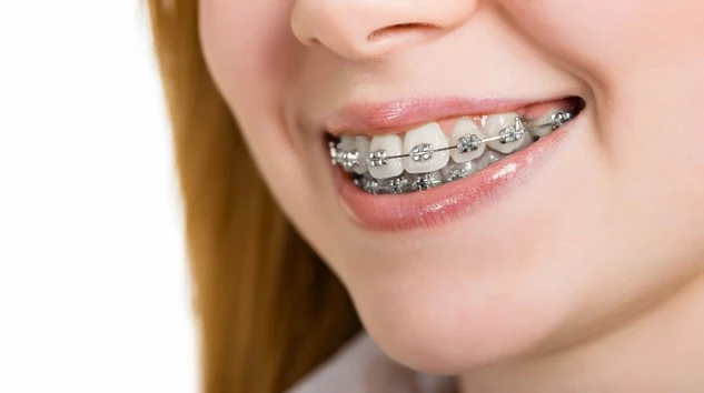Ortodonti ile Düzgün Dişler